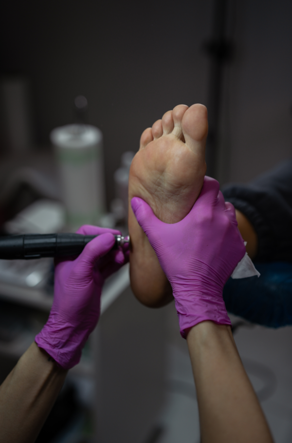 Szkolenie No. 2 Plany terapii skóry problematycznej stóp